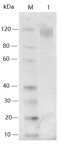 SARS-CoV-2 Spike Protein (S1, Del 69-70, His Tag)